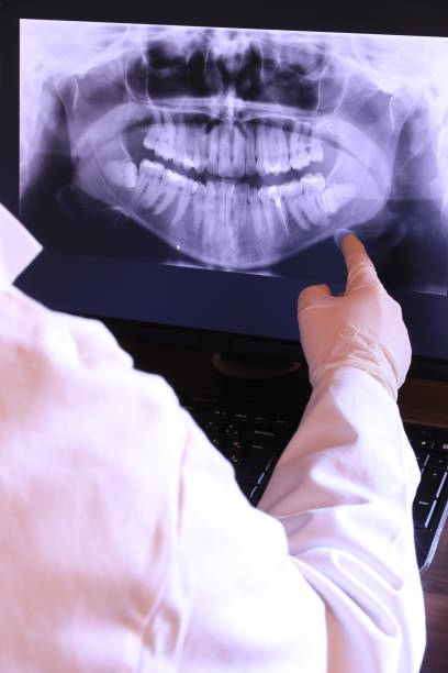 Best Teeth Whitening  in Botkins, OH