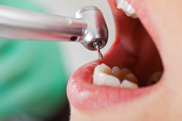 Best Knocked-Out Tooth Emergency  in Botkins, OH